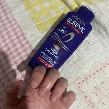 Loreal Paris Elseve Şampuan Kullanımı Sonrası Saç Dökülmesi Ve Kaşıntı