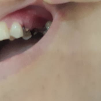 Medipol Sağlık Grubu Esenler Diş Hastanesinde 05.04.23'de Civil'i Diş Tedavisi İçin