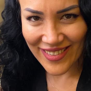 Op. Dr. Hüseyin Burak Bayraktar Burnumu Yamuk Yaptı