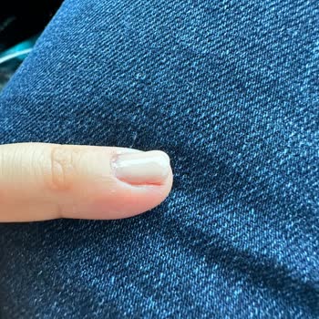 Eylül Öztürk Nail Spa Memnuniyetsizlik Yaşama