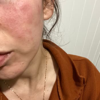 La Roche - Posay Lipikar Baume Light 400ml Krem Yüzümü Yaktı