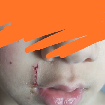 Viaport Marina Tuzla Marinada Kedi Saldırısı