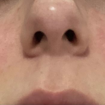 Rise & Shine Pişmanlıktır! Yüzüm Mahvoldu