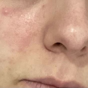 Rise & Shine Pişmanlıktır! Yüzüm Mahvoldu