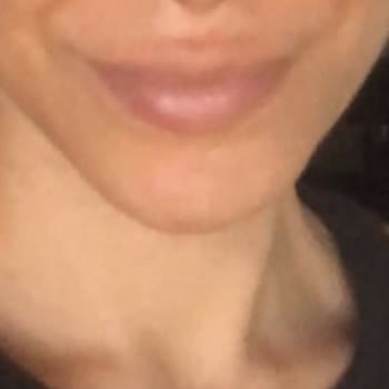 Linemed Beauty Linemed Yüzümü Mahvetti