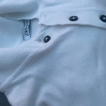 Zara Ürün Üzerinde Deforme Meydana Geldi Ve Mağaza Kabul Etmedi