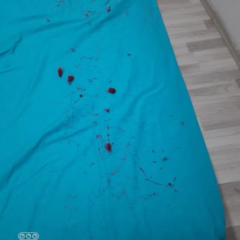 Madame Coco Battaniye Tüy Dökme Sorunu