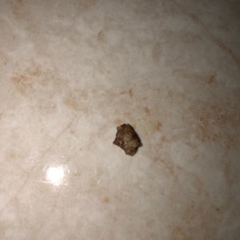 Eti Gıda Karam Çikolatanın İçinden Anlayamadığım Bir Cisim Çıktı