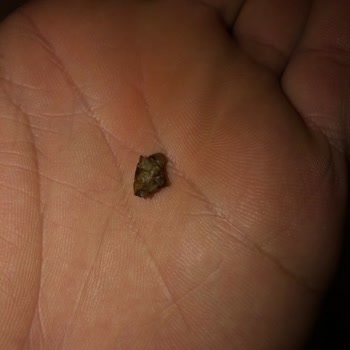 Eti Gıda Karam Çikolatanın İçinden Anlayamadığım Bir Cisim Çıktı