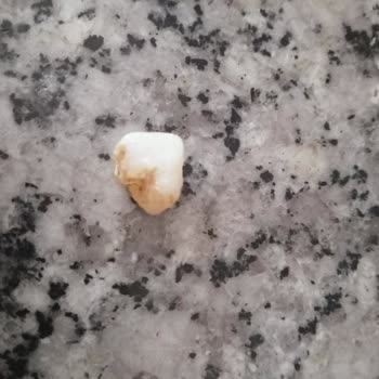 Yayla Bakliyat Yayla Barbunya Pilakiden Taş Çıkması