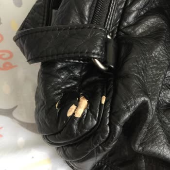 Mavi Marka Sırt Çantasının Derisi Döküldü