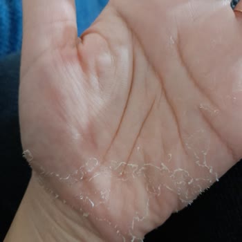 Dove Sıvı Sabun Ellerime Zarar Verdi