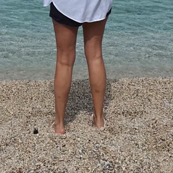 Hillside Hotels'de Yapılan Masaj Sağlığımdan Etti