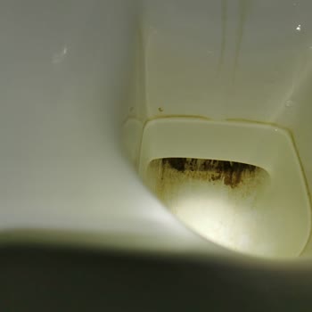 İdeal Standard Banyo Klozet Dibinde Atıkların Tutunması