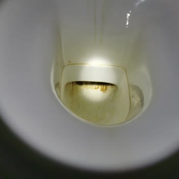 İdeal Standard Banyo Klozet Dibinde Atıkların Tutunması