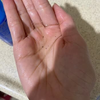 Procsin Yuz Temizleme Şikayet