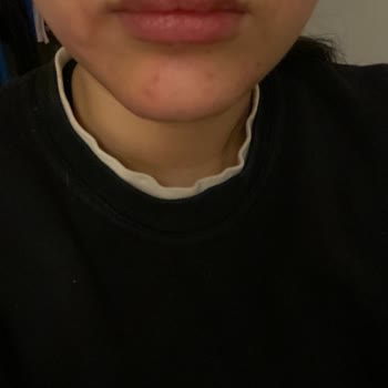 Yves Rocher (anti -AGE Global) Serumu Ve Hayal Kırıklığı