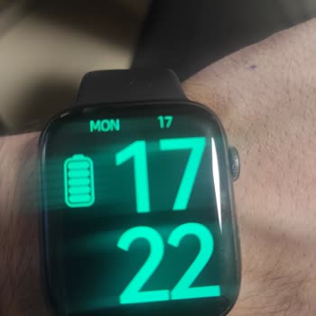 Technomen Watch 7 DT Max Plus Şarj Olduktan Sonra Dondu Tepki Vermiyor