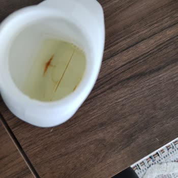 Incia Ürün İçerisinde Çökme Ve Muhatap Bulamama