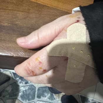 Durul Duşakabin Cam Patlaması