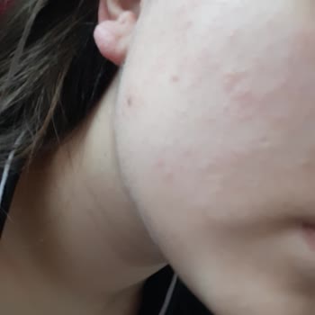 Rise & Shine Maderise Ve Pirinç Özlü Sabun