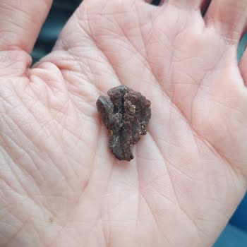 Haribo Jelibon Paketinde Yabancı Madde