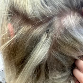 The Most Kuaför Bahçeşehir Saç Yanması Ve Saç Derisinde Yaralar