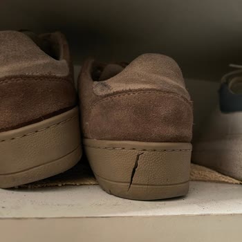 Tergan Deri Kalitesizliği