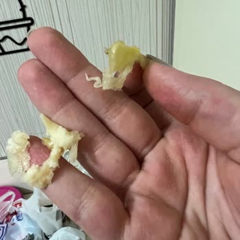 Mis Başak Su Böreğinden Saç Çıktı