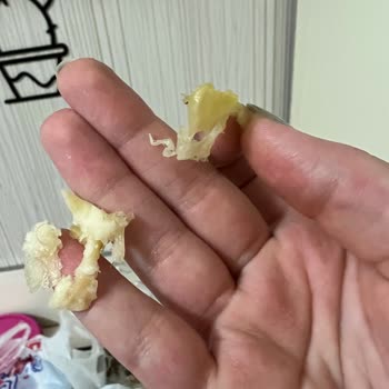 Mis Başak Su Böreğinden Saç Çıktı