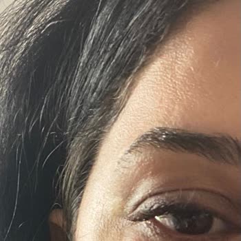 Dr. İhsan Başaran Göz Altı Işık Dolgusu