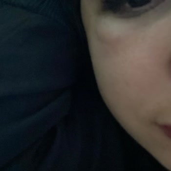 Dr. İhsan Başaran Göz Altı Işık Dolgusu