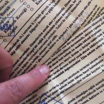 Livangel Güzellik Merkezi Lazer Epilasyon Hüsrandır