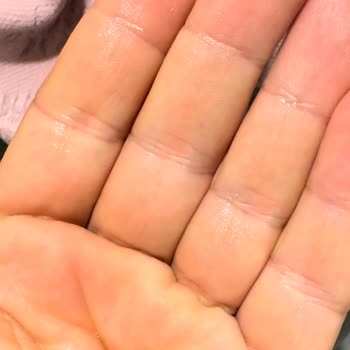 Vestel Km 10701 G 10 Kg Kurutma Makinesi