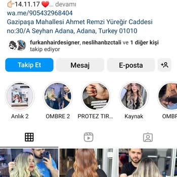 Hairdesign By Çağrı Salar Saçımı Yaktı