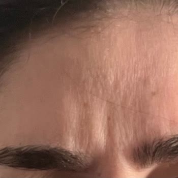 Dr. Ayşegül Saltat Kliniği Botoks Ve Dudak Dolgusu Hizmeti Kötü!