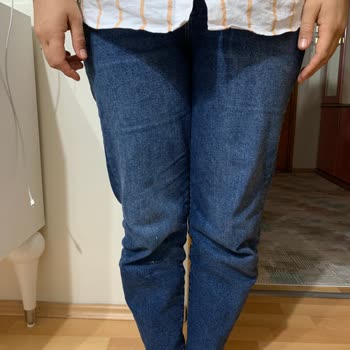 Mavi Pantolon Diz İzi Çıkardı