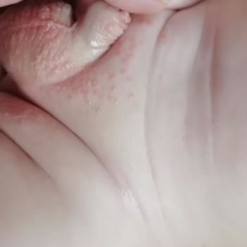 Bebem Natural Bebem Naturel Bebek Bezi Pişik