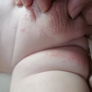 Bebem Natural Bebem Naturel Bebek Bezi Pişik