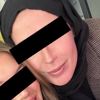 Estpoint Skandalı Ve Jawline Mağduriyeti