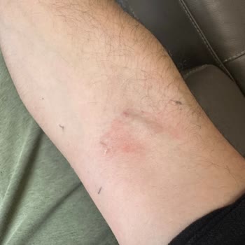 McDonald's Gıda Zehirlenmesi Sorunu