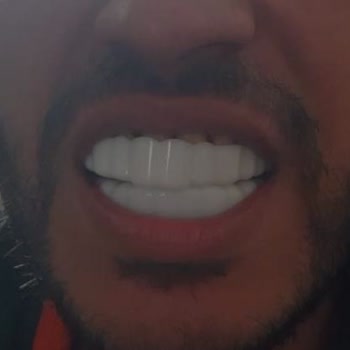 Smilexpresstr (Instagram) Silikon Diş Diye Oyuncak Yolladı