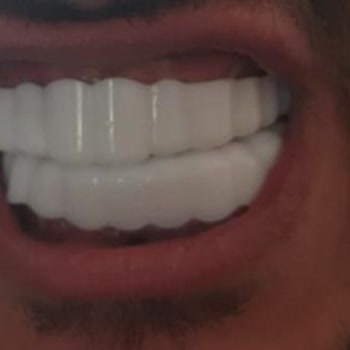 Smilexpresstr (Instagram) Silikon Diş Diye Oyuncak Yolladı