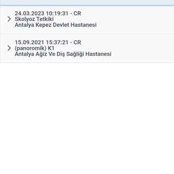 E-Nabız Röntgen Sonucum Çıkmıyor.