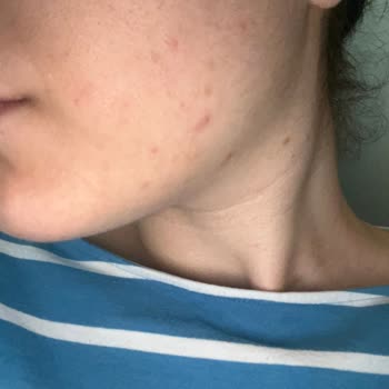 Yves Rocher Kalitesiz Krem Ve Serum