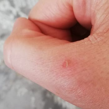 Dyson V15 Kablosuz Süpürge