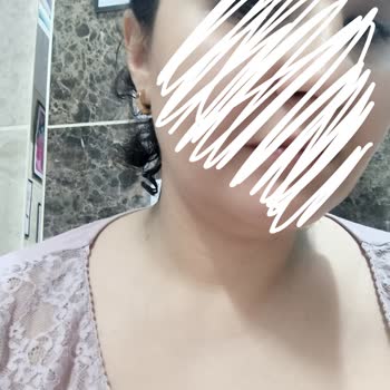 Jewel Aksesuar Kararma Ve Boyama Sorunu