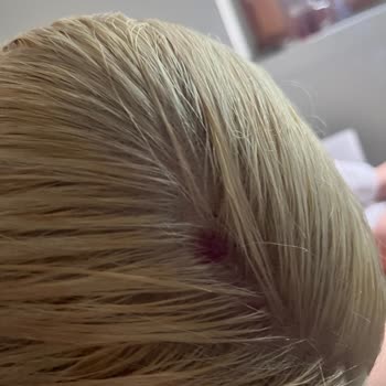 Palette Deluxe Ultra Yoğun Renk Açıcı Saç Derimi Yaraladı