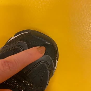 Skechers Mağazasından Aldığım Ayakkabı 5 Ayda Çöktü