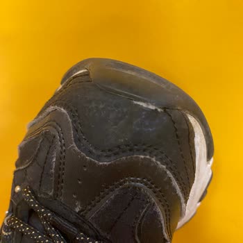 Skechers Mağazasından Aldığım Ayakkabı 5 Ayda Çöktü